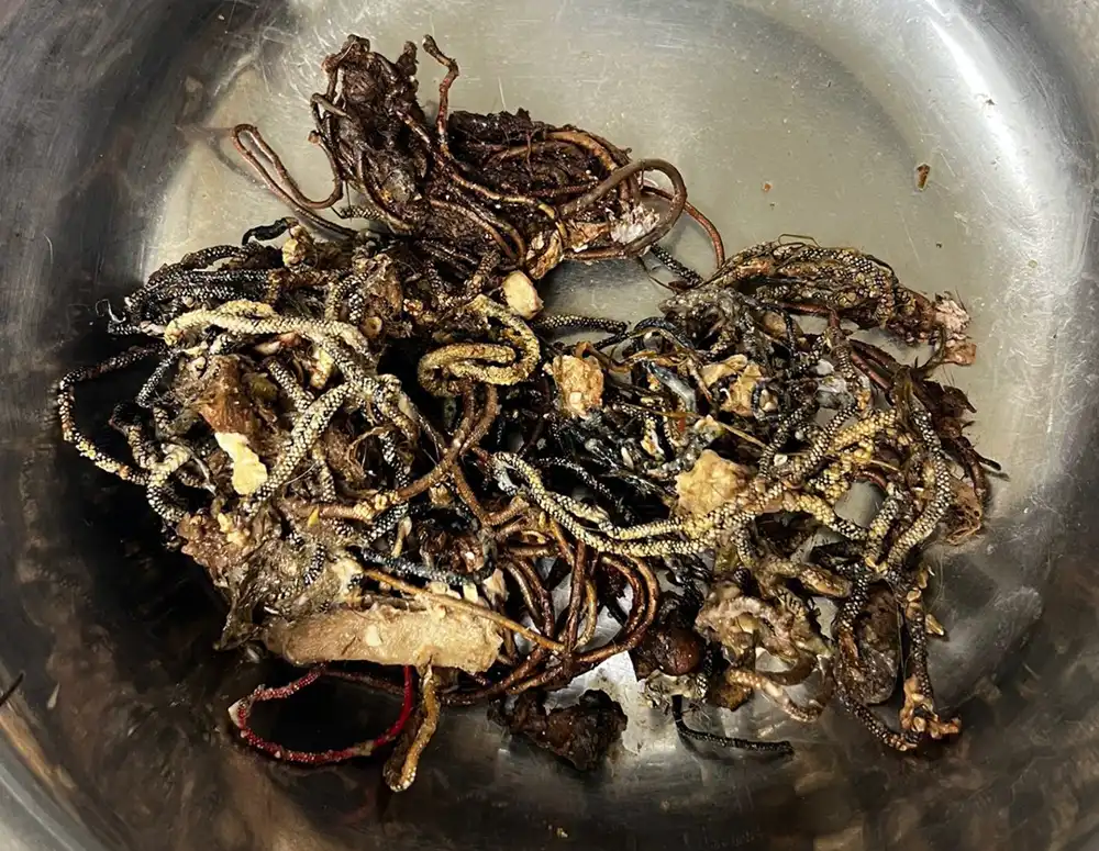 The hairbands removed from Ham's stomach. Picture: Newton Clarke